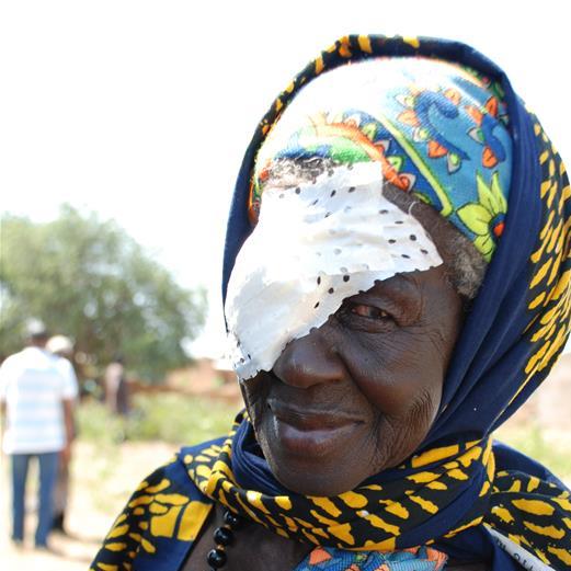 Woman after trachoma surgery
