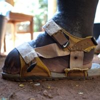 Foot with elephantiasis.