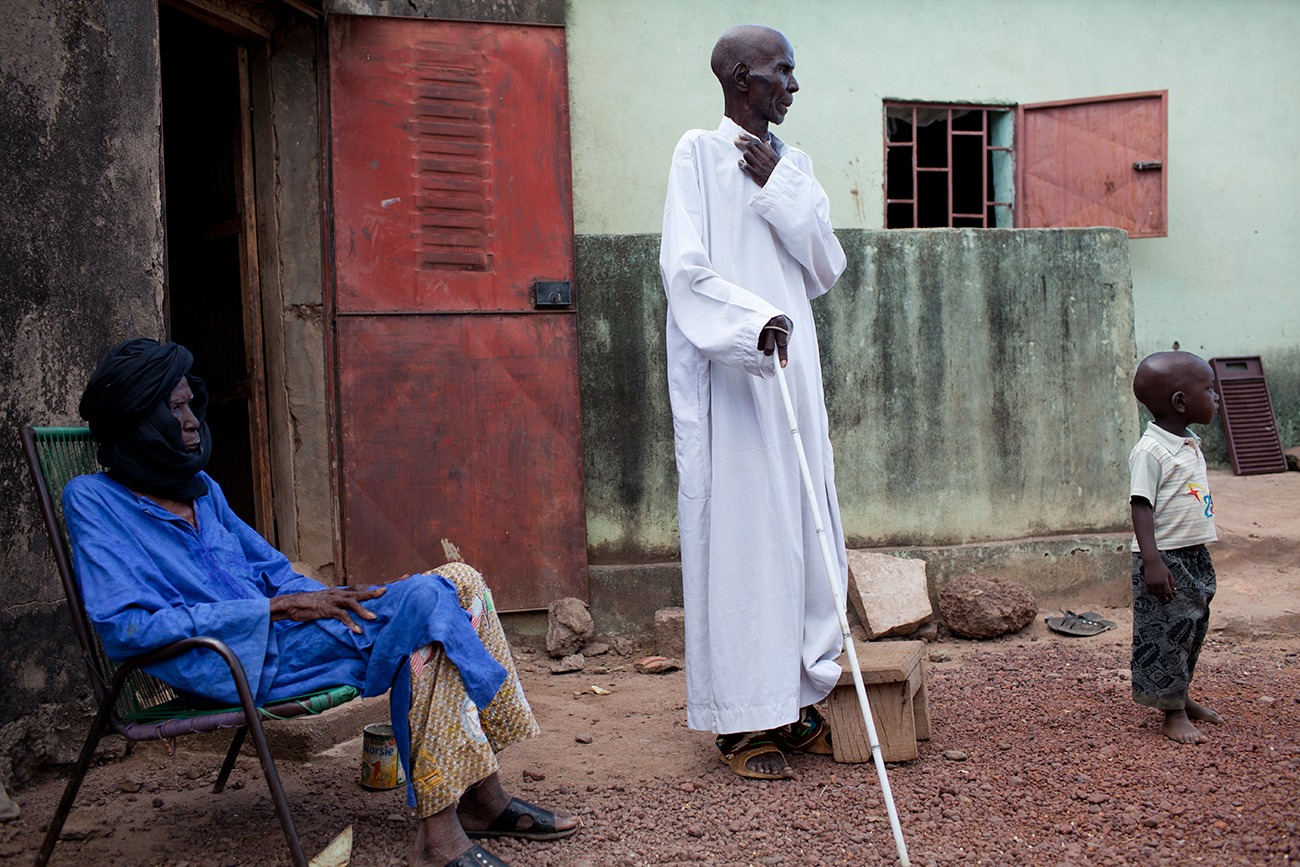Moce is blind due to river blindness. He walks with a stick and a child to lead his way.