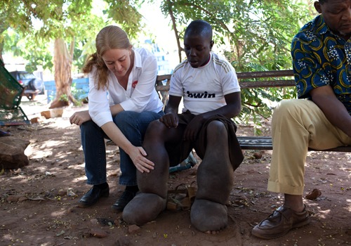 CEO Ellen Agler speaking with child that suffers from elephantiasis.