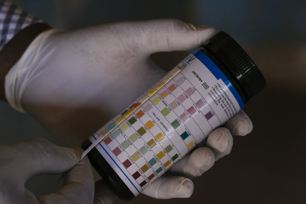 Laboratory testing materials support monitoring of deworming programs effectiveness in eliminating neglected tropical diseases in  Kenya